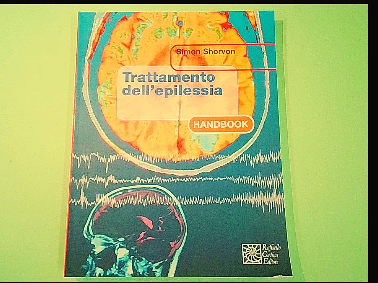 TRATTAMENTO DELL'EPILESSIA