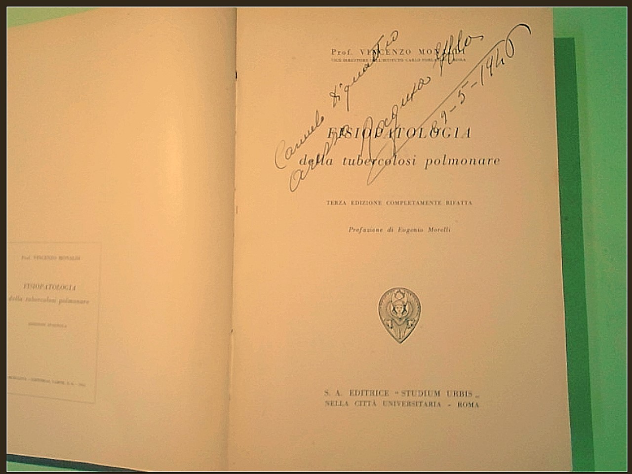 FISIOPATOLOGIA DELLA TUBERCOLOSI POLMONARE - immagine 2