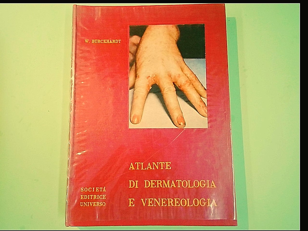 ATLANTE DI DERMATOLOGIA E VENEREOLOGIA