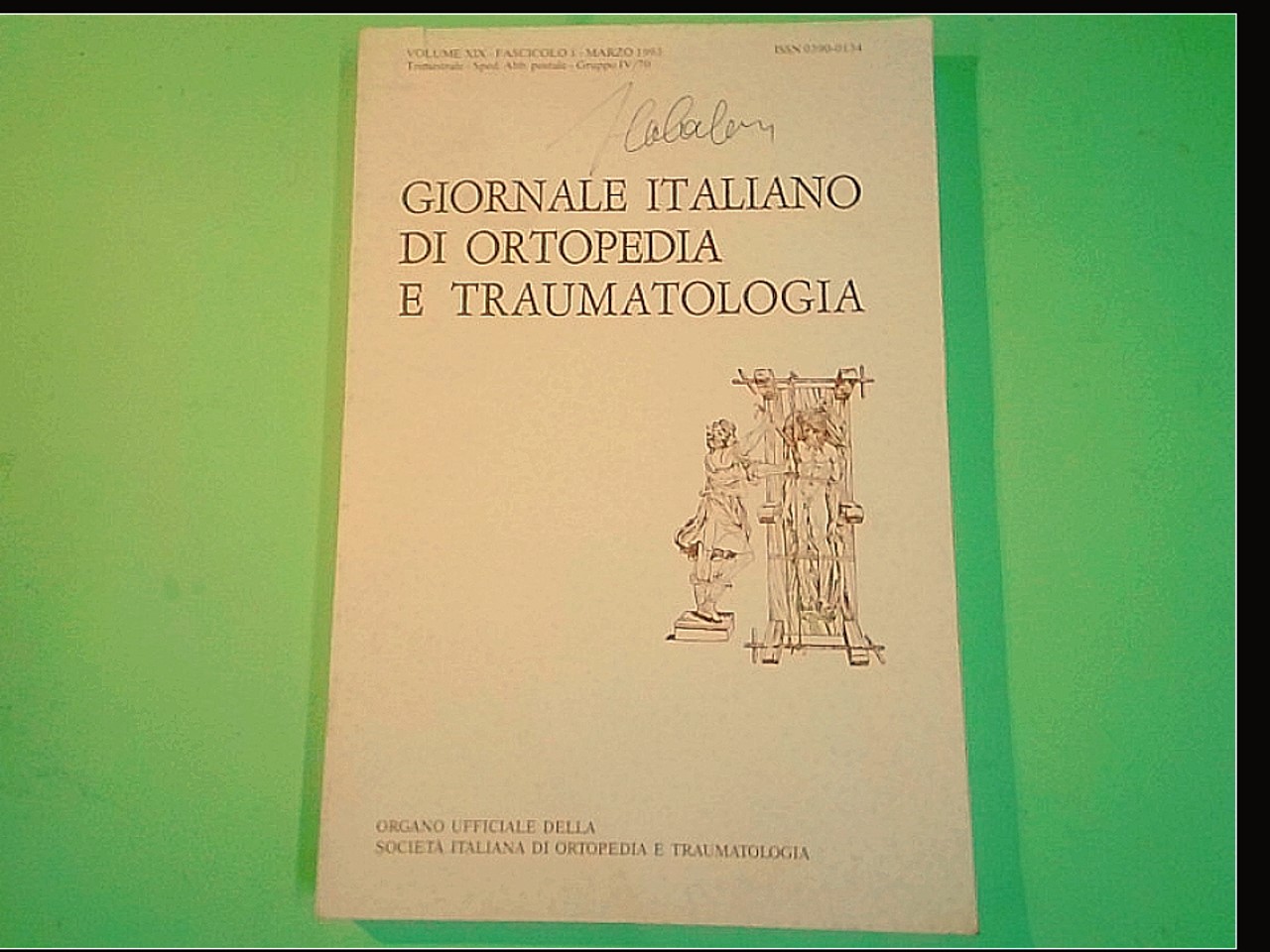 GIORNALE ITALIANO DI ORTOPEDIA E TRAUMATOLOGIA MARZO 1993 VOL XIX FASC. 1