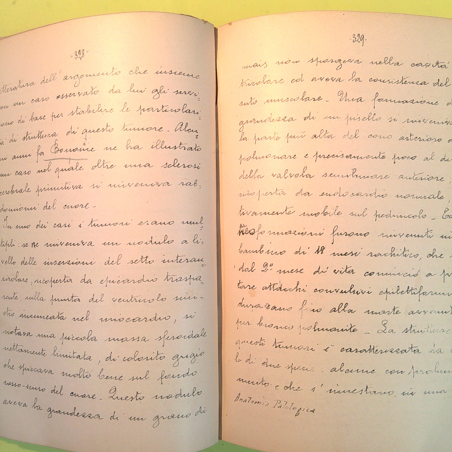 APPUNTI MANOSCRITTI DELLE LEZIONI DI ANATOMIA PATOLOGICA PROF DIONISI 1910-11 - immagine 4
