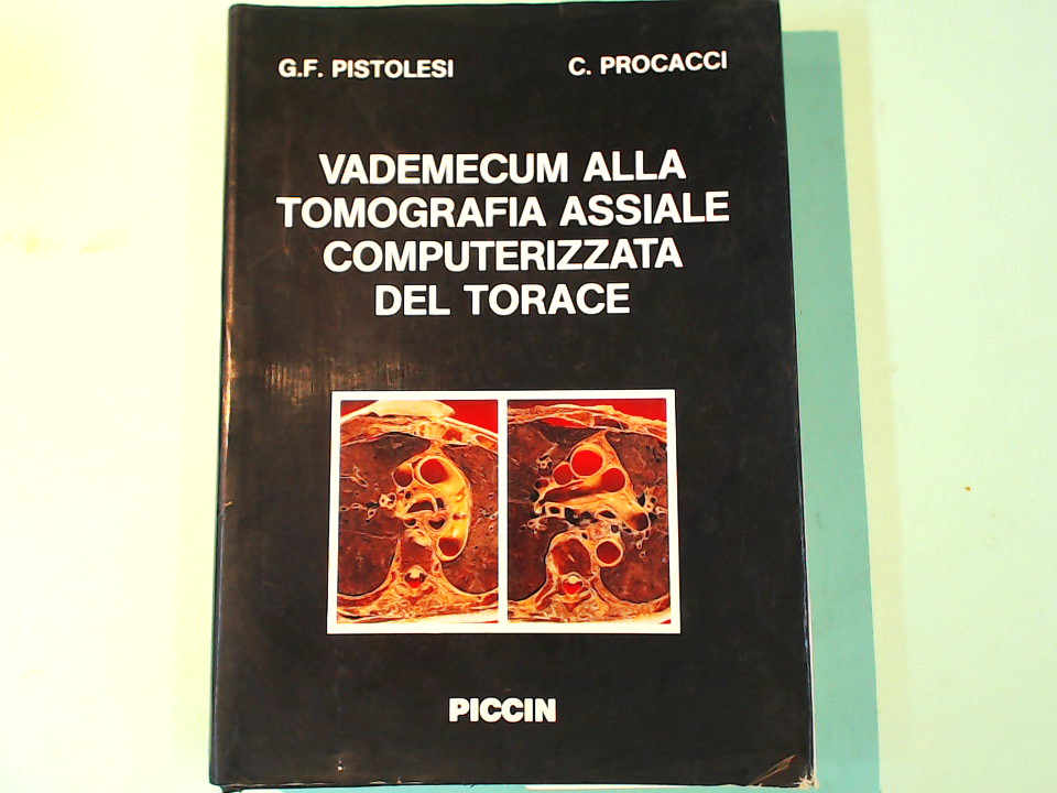 VADEMECUM TOMOGRAFIA ASSIALE COMPUTERIZZATA DEL TORACE