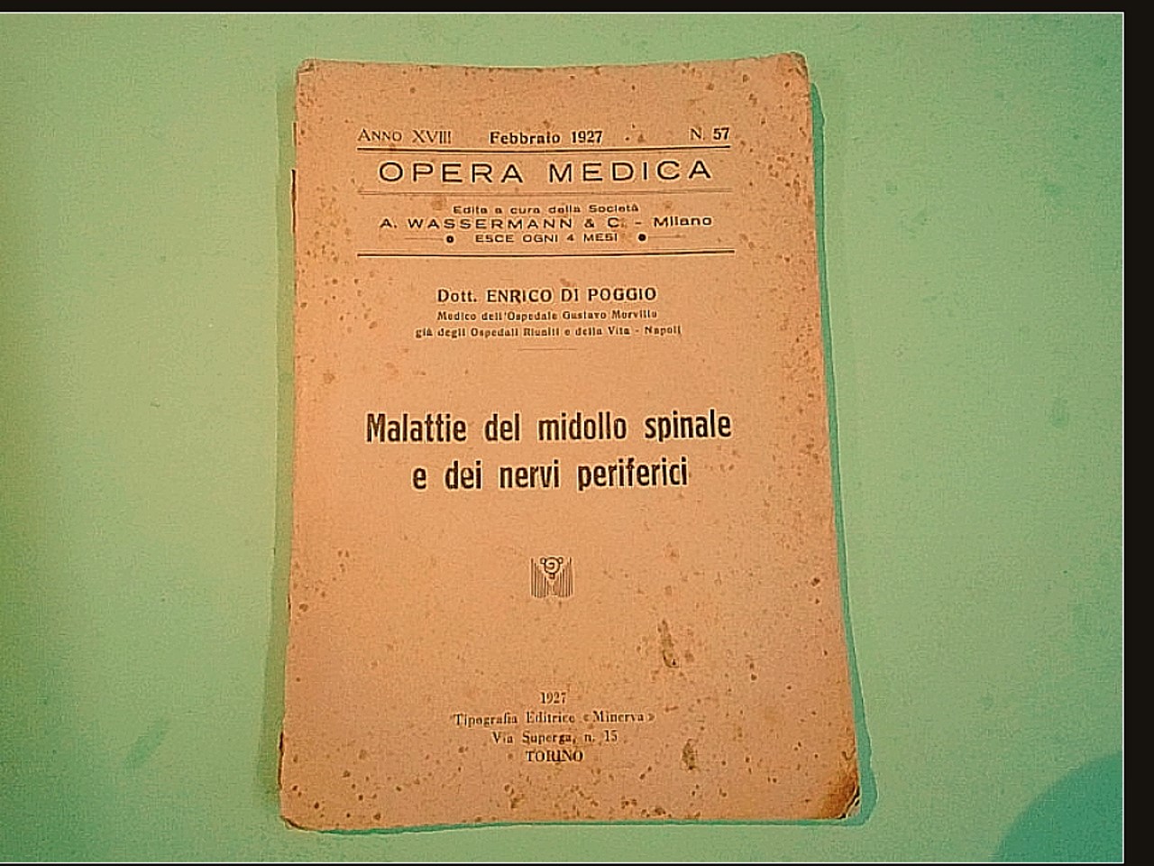 MALATTIE DEL MIDOLLO SPINALE E DEI NERVI PERIFERICI