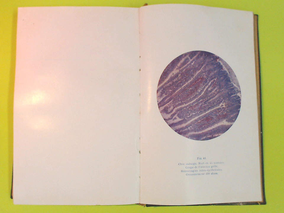 LE PROBLEME DE L'ANAPHYLAXIE - immagine 5