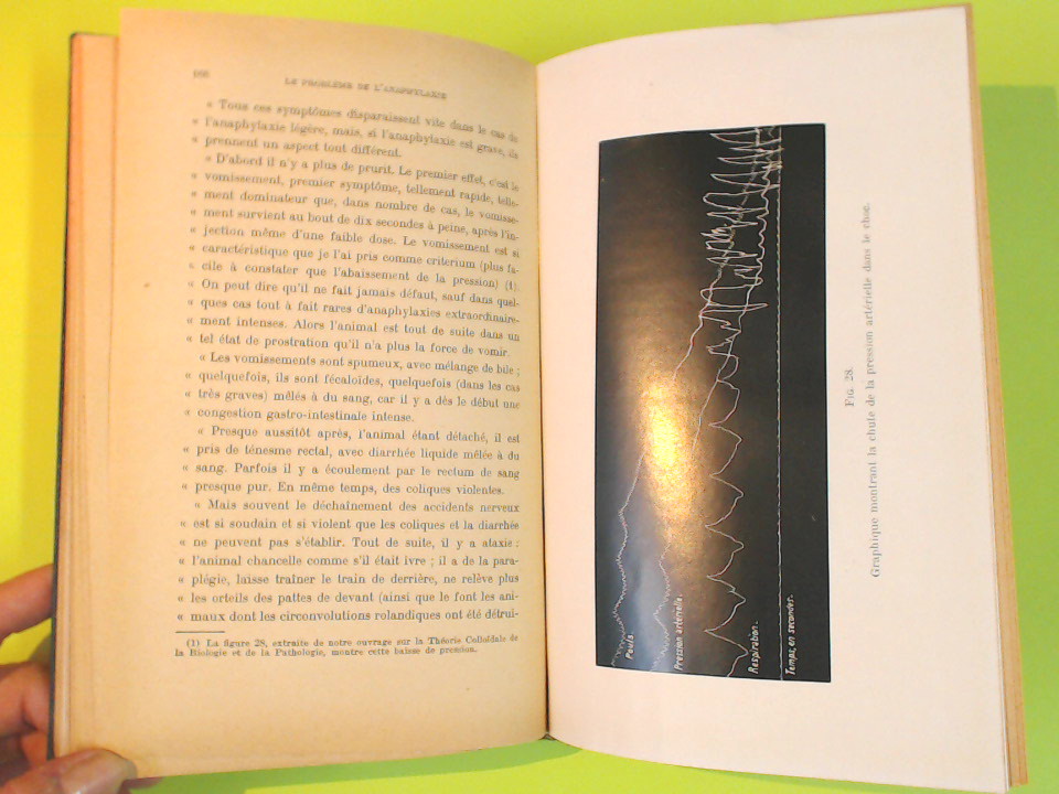 LE PROBLEME DE L'ANAPHYLAXIE - immagine 4