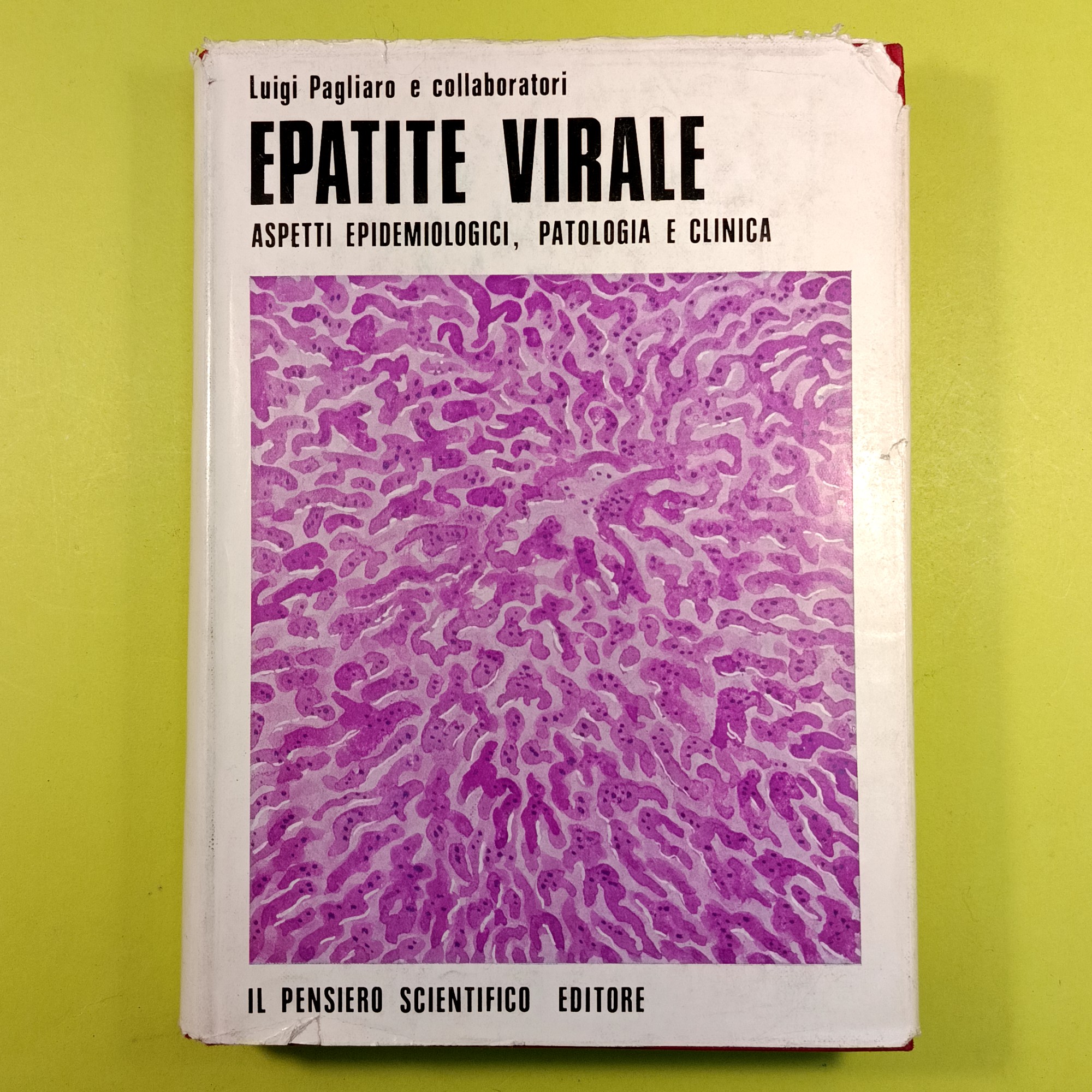 EPATITE VIRALE