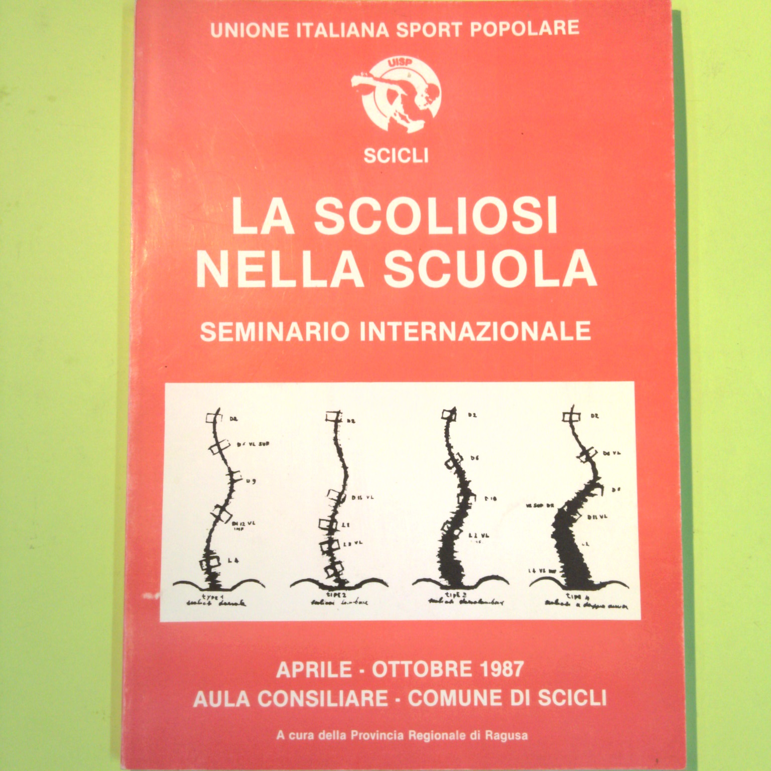 LA SCOLIOSI NELLA SCUOLA