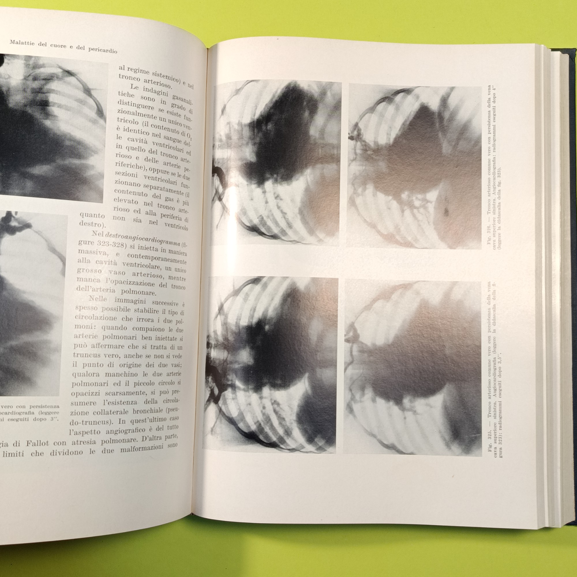 TRATTATO DI SEMEIOTICA E DIAGNOSTICA CHIRURGICA VOL III - immagine 5