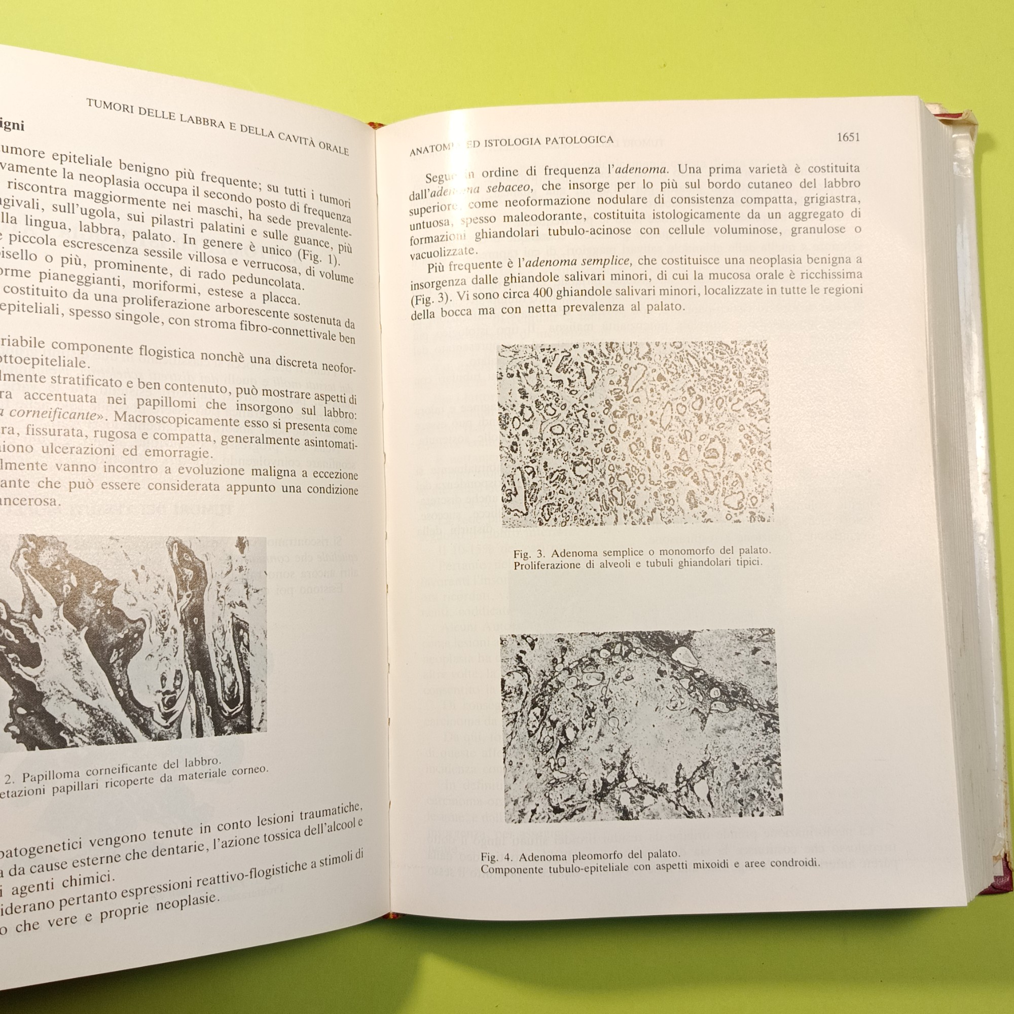 TRATTATO DI CLINICA ONCOLOGICA Volume III/2 - immagine 4