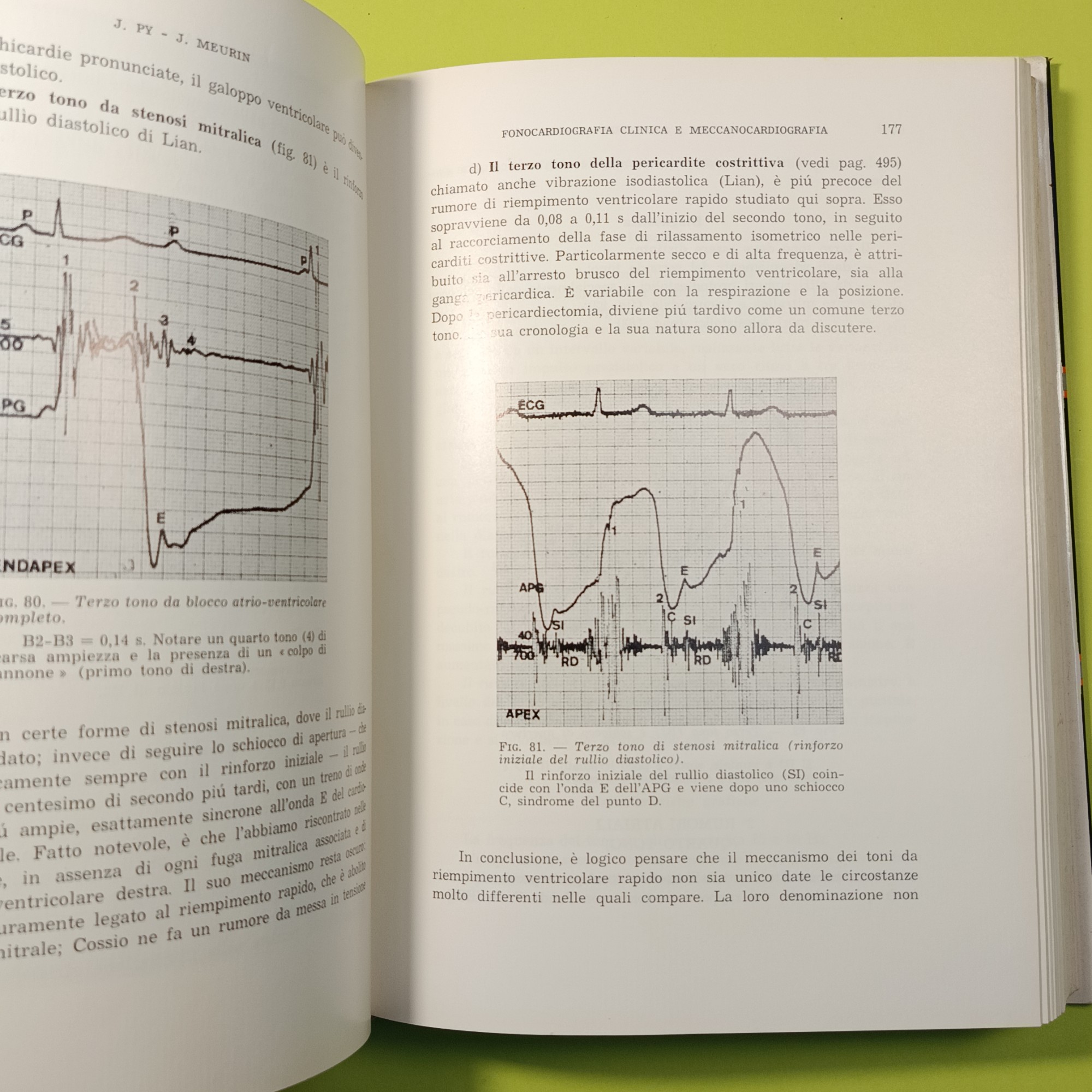 FONOCARDIOGRAFIA CLINICA E MECCANOCARDIOGRAFIA - immagine 4